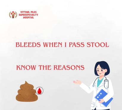Bleeding While Passing Stool – Should You Worry?